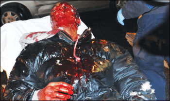 bloodied-2009-11-24_z