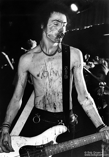 The Sex Pistols’ Sid Vicious sported a sliced-up torso during the band’s anarchic 1978 American tour. Fortunately, photographer Bob Gruen had cleaned and bandaged a deep, self-inflicted cut on the inside of the bass player’s left elbow. The bandage is visible in this photo. However, by one account, Vicious later tore it off and flung the bloody mess out into the crowd at one of the shows. But Gruen said he didn’t see that. There are a lot of conflicting accounts about what happened on the tour, he noted. “It’s like ‘Rashomon,’ ” he said, “depending on where you were at the time.”  Photos by Bob Gruen