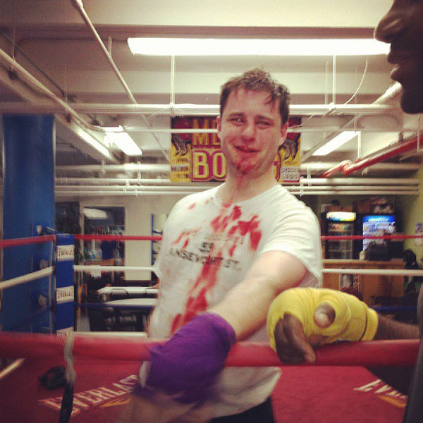 Joey Goodwin sported a bloody nose and blood-spattered T-shirt after a sparring session while training for the Golden Gloves.