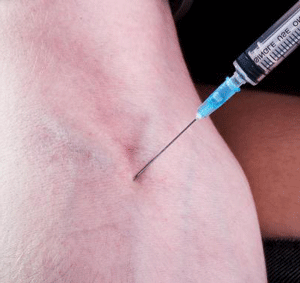 needle-in-arm