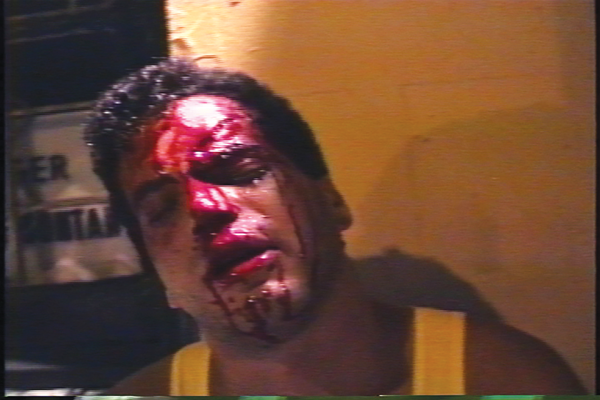 In a grab from Clayton Patterson’s 1988 Tompkins Square Park riot videotape, Ken Fish is shown bloodied after being struck by police. A New York Times article on the riot reported that Fish, 29, was a bystander who had been clubbed by police and needed 44 stitches to close a 3-inch gash in his forehead. 