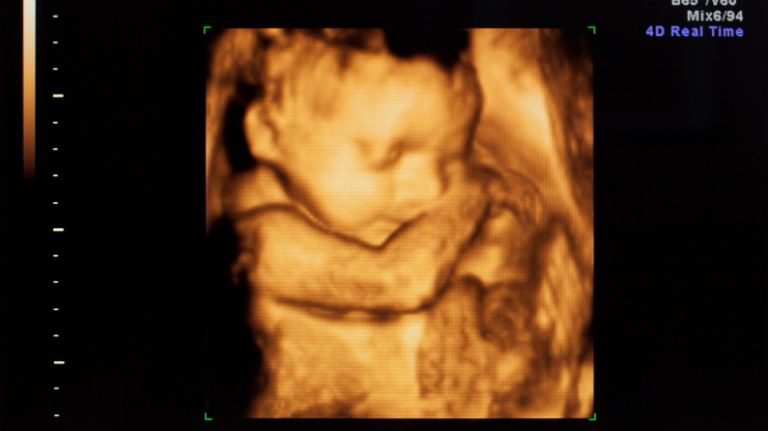 Sonogram istock cropped