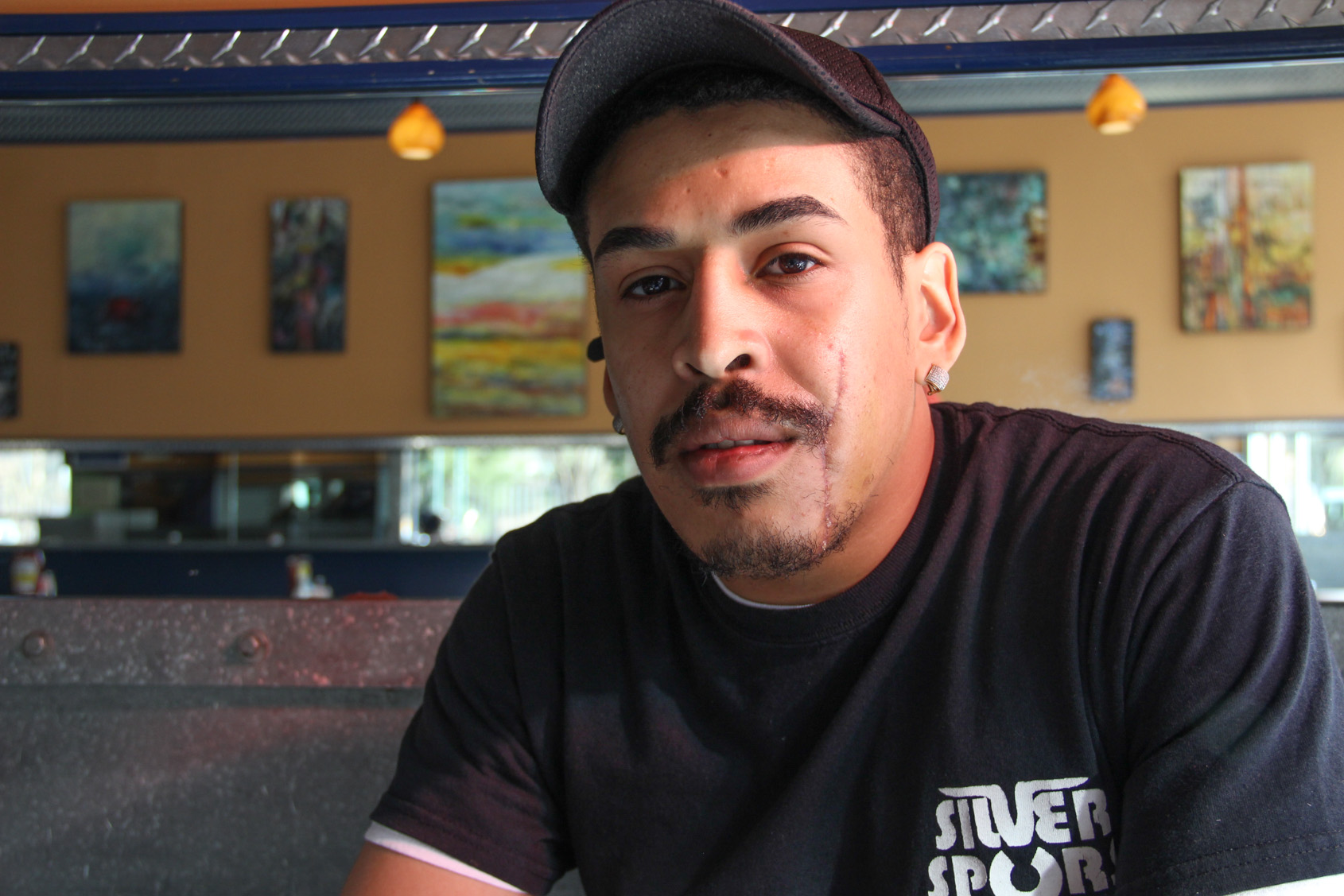‘I’m feeling good’: Diner slash victim back at work 1 Bobby Barbot had to get 135 stitches to close the long gash on his cheek. Photo by Tequila Minsky