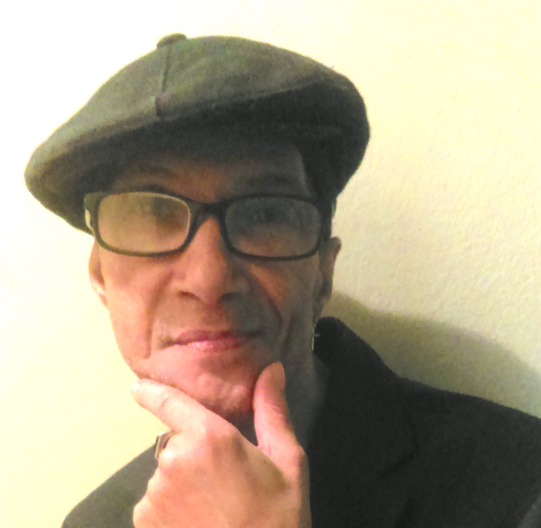 On World AIDS Day, remembering my brother Harry 1 Dennis Levy.