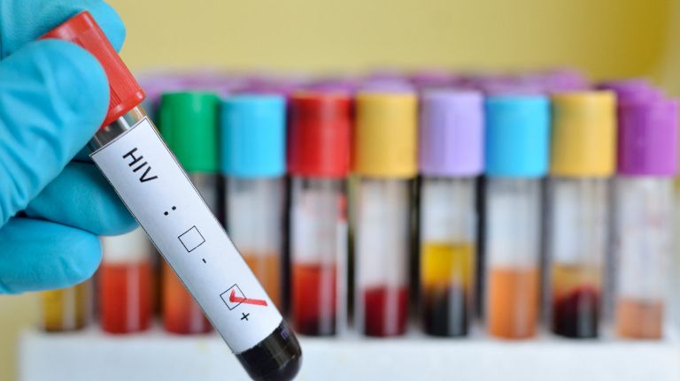 HIV diagnoses in NYC at record low, health department says 2 The number of new HIV diagnoses in New York City dropped 8.3 percent between 2014 and 2015, according to the health department.