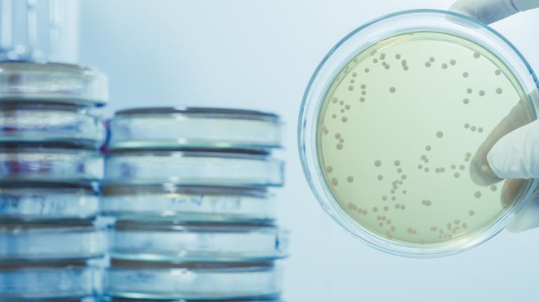 Legionnaires’ disease in Lenox Hill kills 1, sickens several others 2 A Legionnaires' disease cluster in Lenox Hill has killed one person and hospitalized six others, the city Health Department said on June 16, 2017.