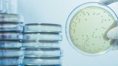 Legionnaires’ Disease /lt