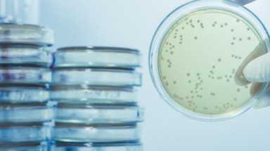 Legionnaires’ disease
