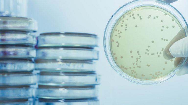 A Legionnaires' disease cluster in Flushing has sickened a dozen people, the Department of Health said.