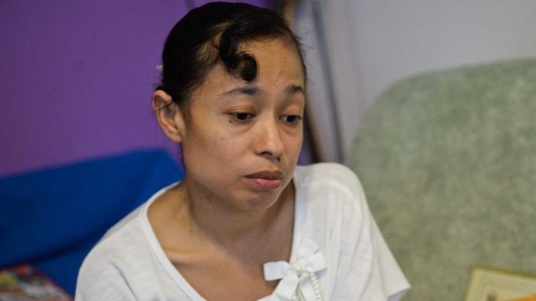 Both of Ruth Bernal de Villalta's kidneys have stopped functioning. Her husband is willing to donate one of his kidneys to her if he's a match, but since both are undocumented immigrants, doctors at the clinic where she gets her dialysis treatments have told her a transplant is impossible. Bernal de Villalta is shown in her Brentwood apartment on Monday, June 15, 2015.