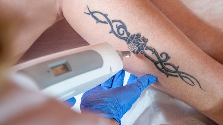 Tattoo removal services will be offered to young victims of trafficking and former gang members through a new Administration for Children's Service program.