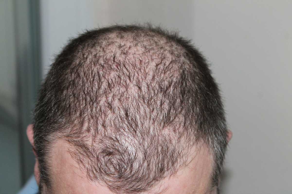 hair-248050_1280