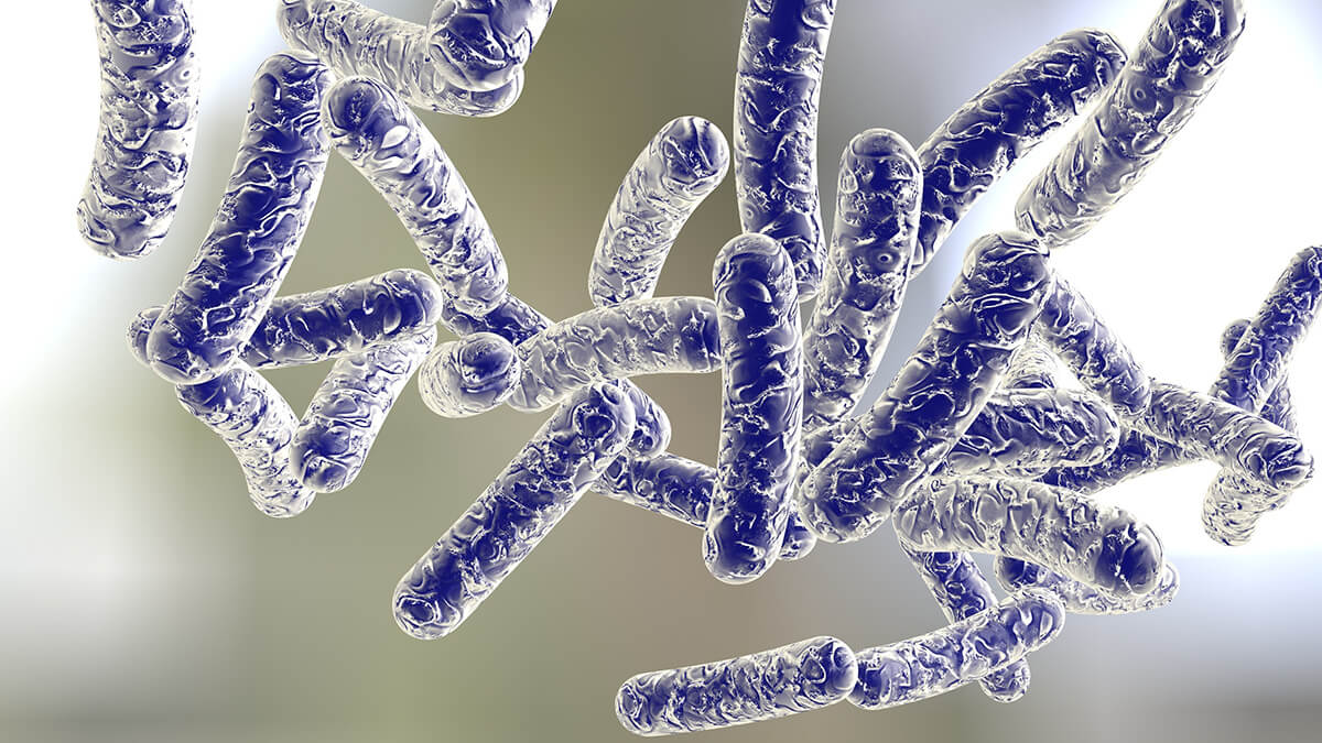 Legionnaires' disease outbreak