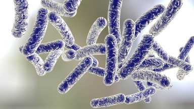 Legionnaires' disease outbreak