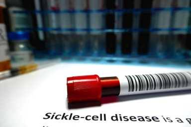 Sickle-cell disease