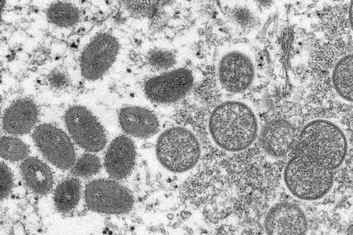 Monkeypox microscopic image