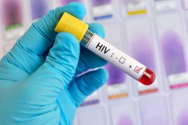 HIV positive blood sample