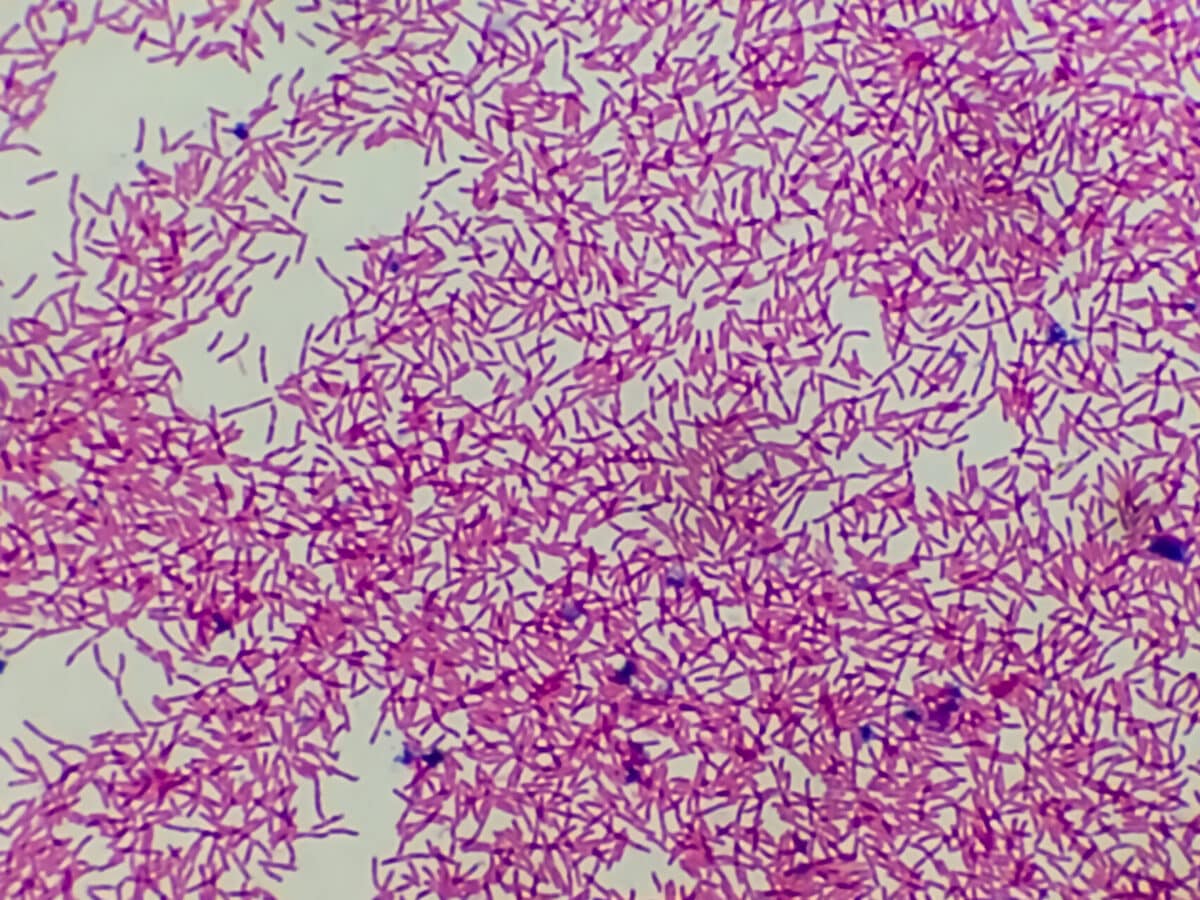 Culture of E. Coli bacteria