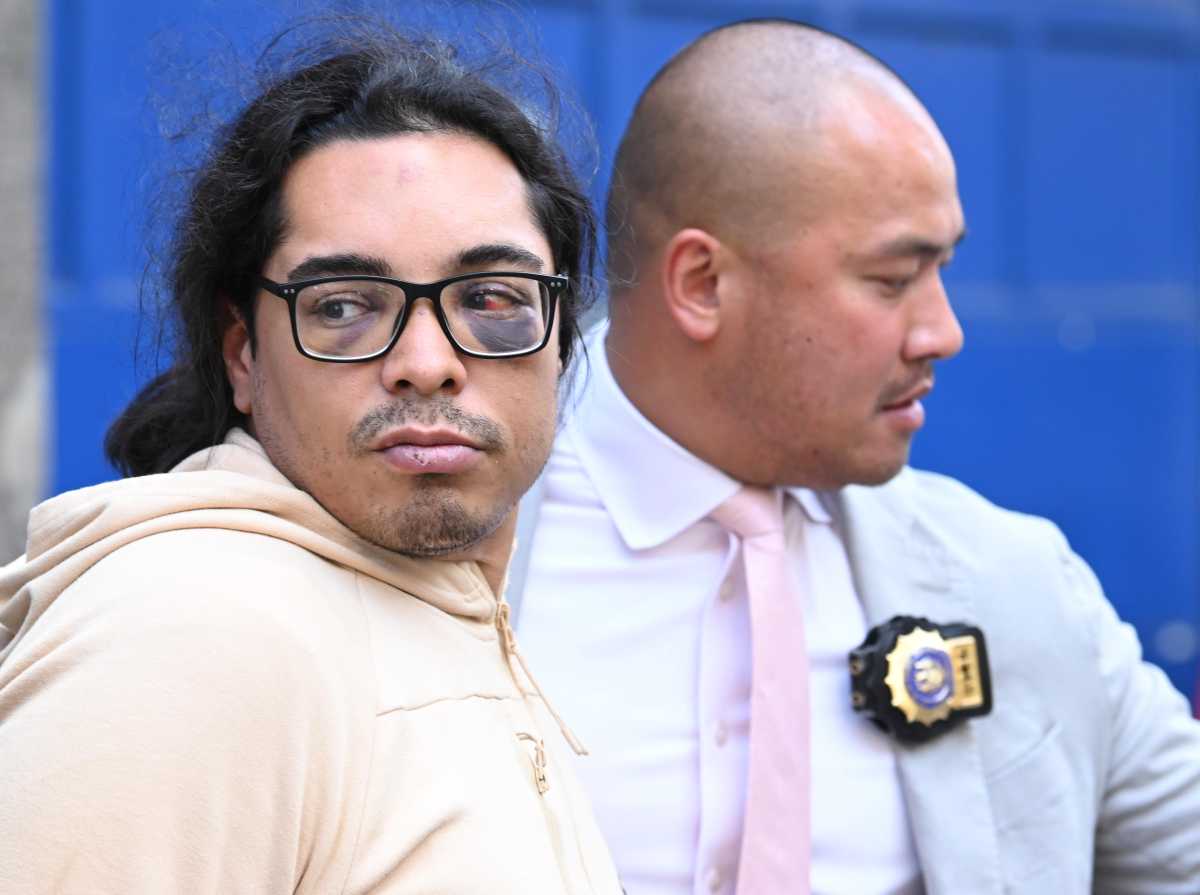 Suspected Manhattan subway creep who kissed woman's feet arrested with black eye